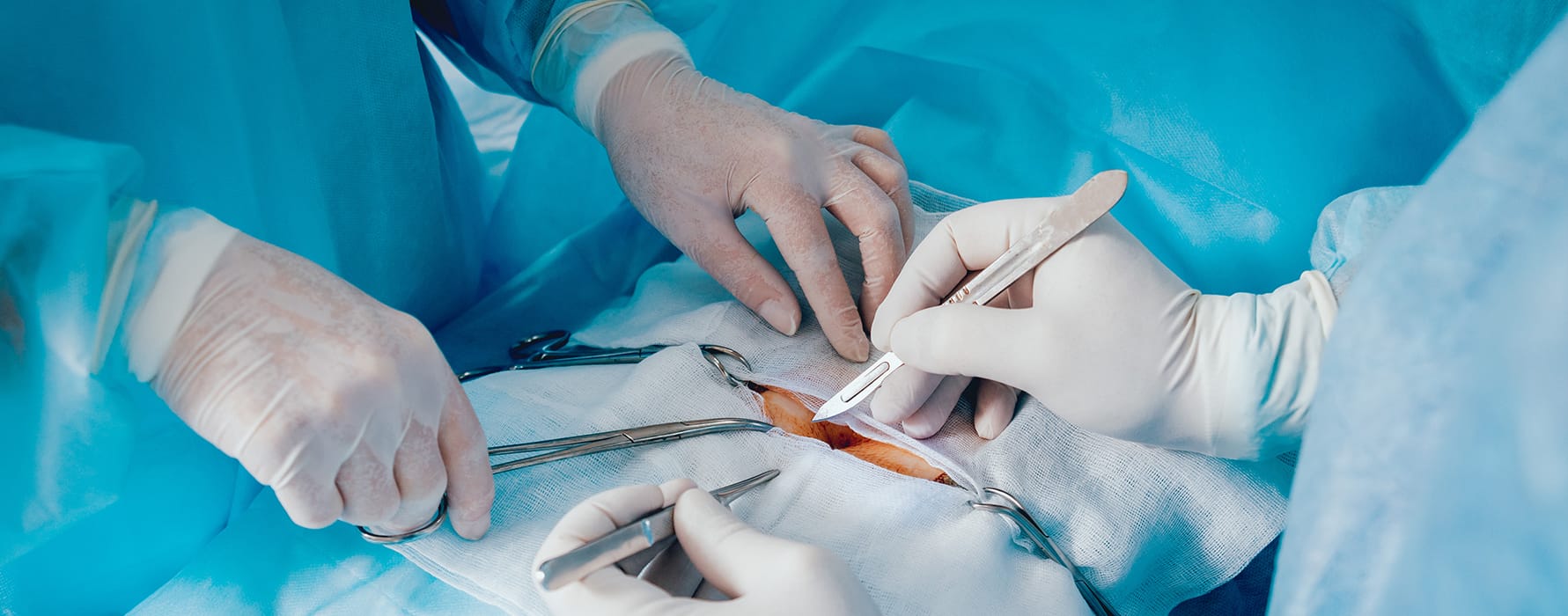 Magen Op Türkei – Qualifizierte Ärzte für Ihre Gesundheit