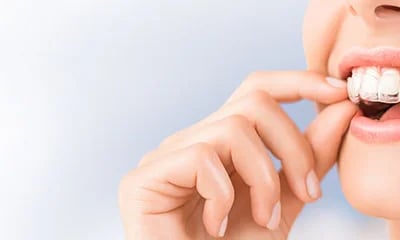 Die besten Apps zur Überwachung Ihrer Zahnschienenbehandlung