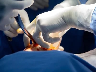 Brustverkleinerung und Ihre Vorteile: Bochum als Zentrum für Ästhetische Chirurgie